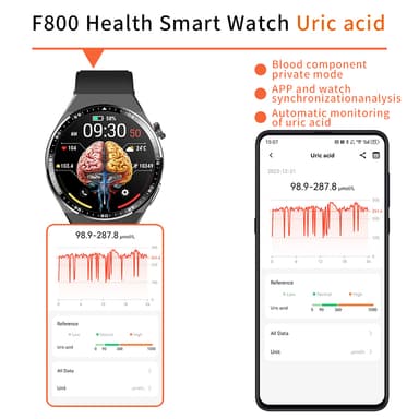 Smartwatch med EKG, kropskompositionsanalyse, blodsammensætningsanalyse (urinsyre, blodlipider) Sort og brun læderrem