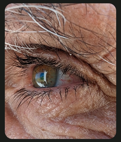 Nærbillede af en ældre mands øje